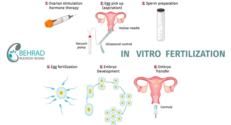 PROCESSING IVF METHODES