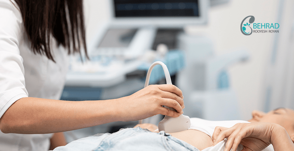 برداشت تخمک