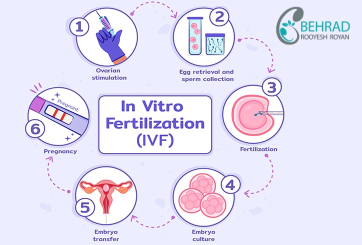 فرایند انجام روش IVF