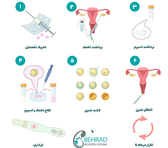 مراحل کاشت جنین به روش ivf