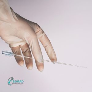 کاتتر iui بهراد رویش رویان (12)