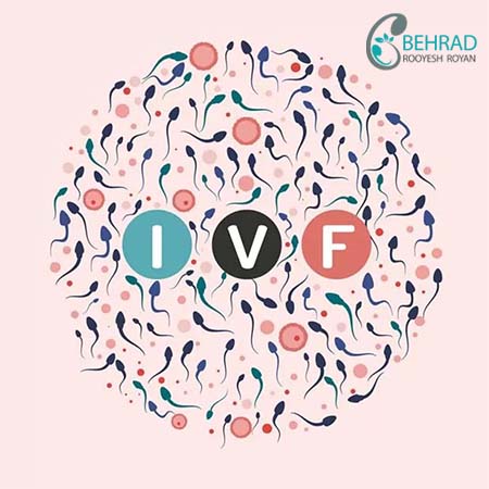 عمل IVF