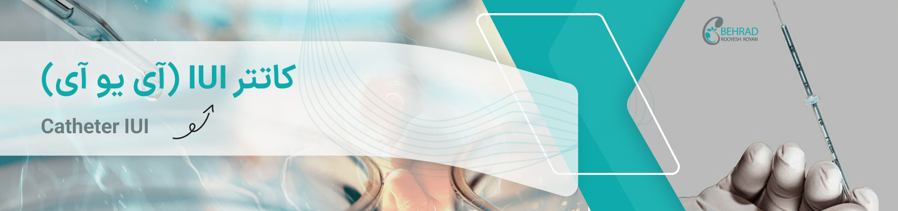 Catheter IUI-4-