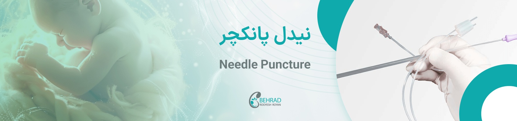 سوزن پانکچر در بهراد رویش رویان