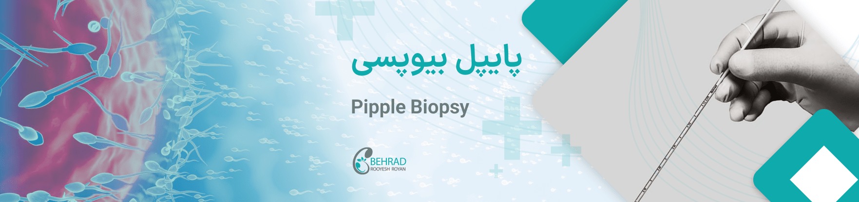 پایپل بیپسی شرکت بهراد رویش رویان