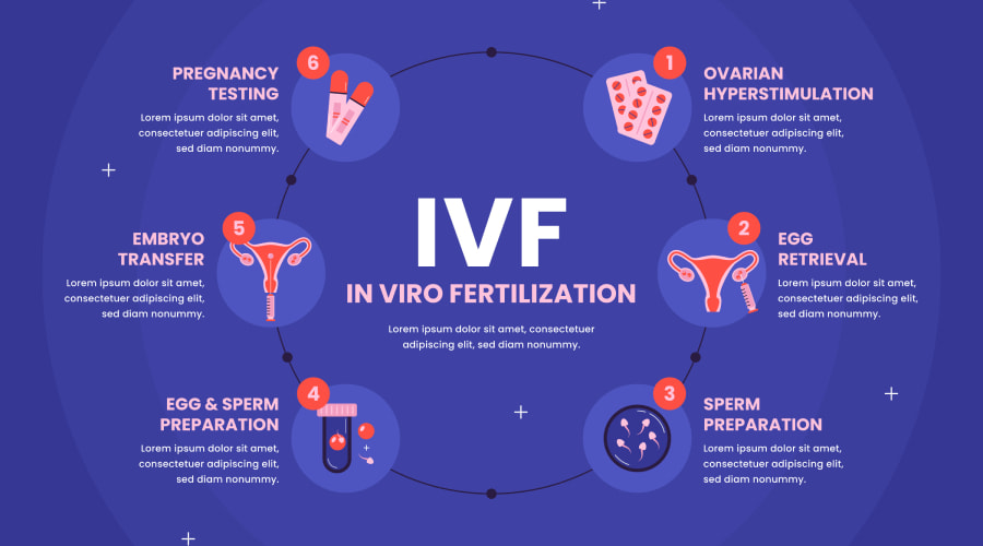 چگونگی ivf