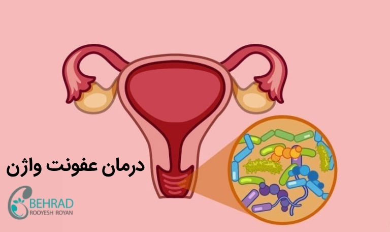 عکس انواع عفونت واژن