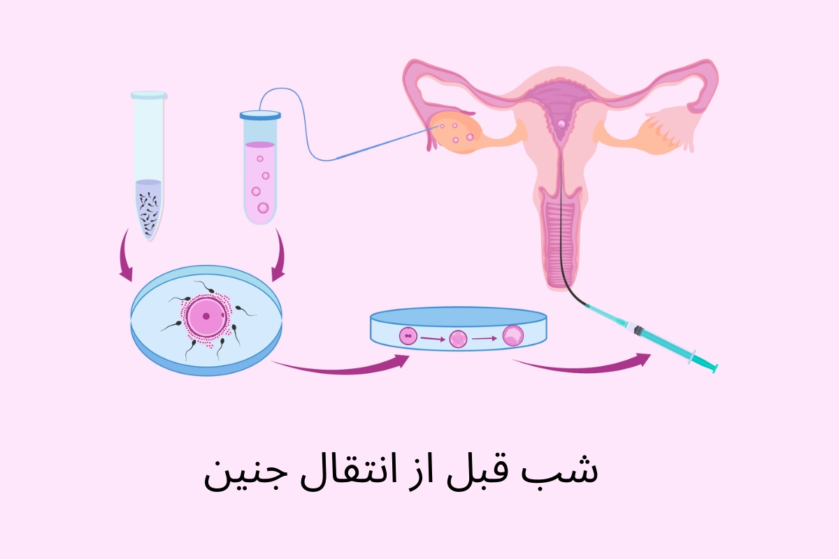 شب قبل از انتقال جنین فریز شده