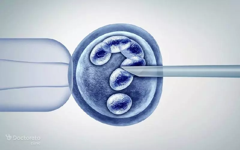 عمل ivf و مراقبت های آن