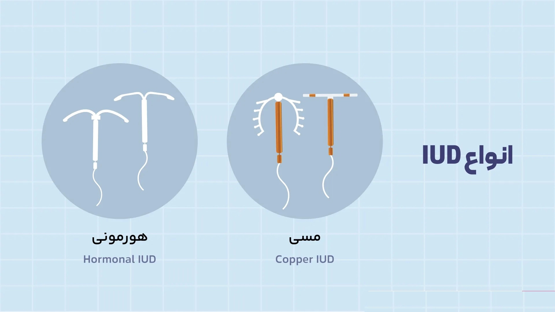 انواع iud - بهراد رویش رویان