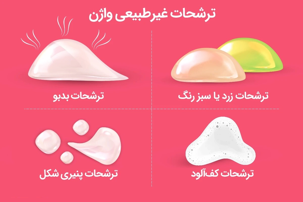 رنگ ترشحات غیرطبیعی واژن
