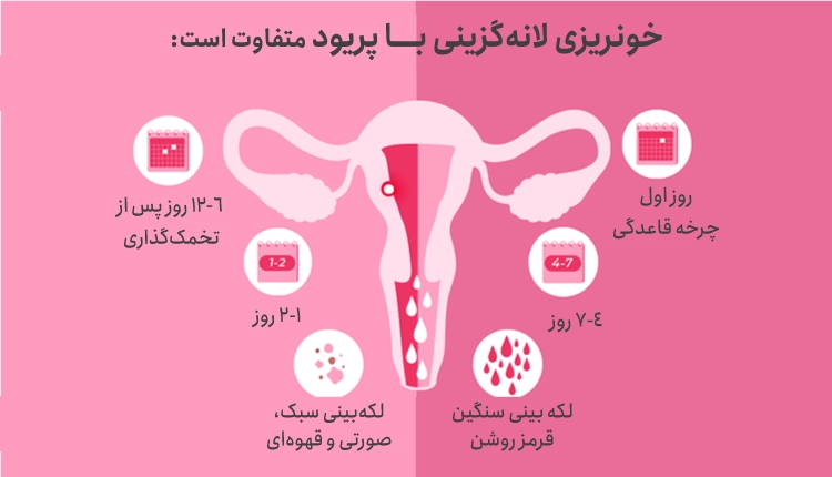 علائم خونریزی لانه گزینی