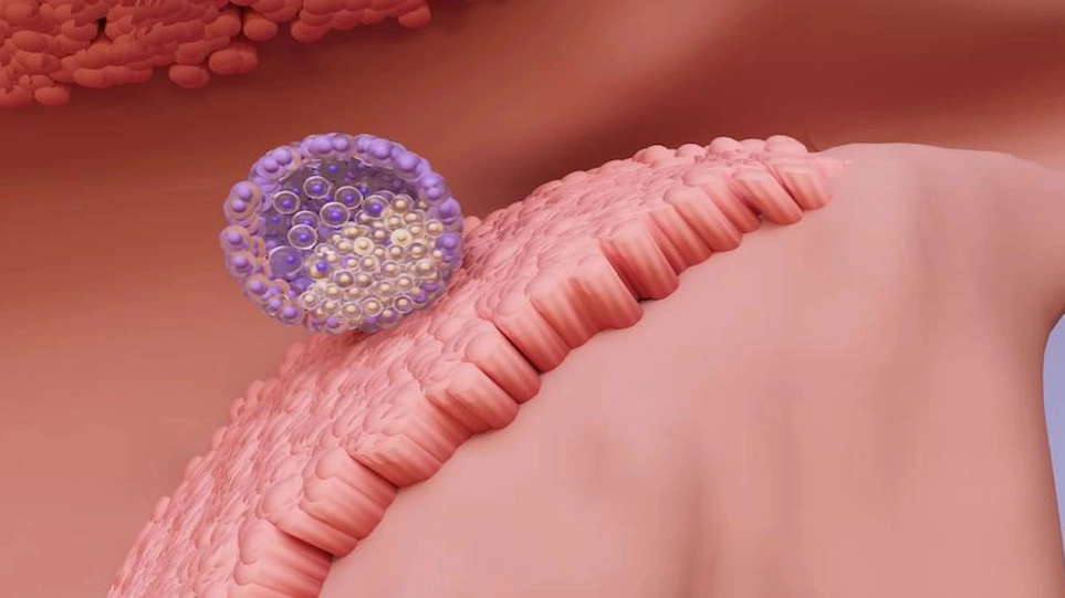 علائم لانه گزینی چیست