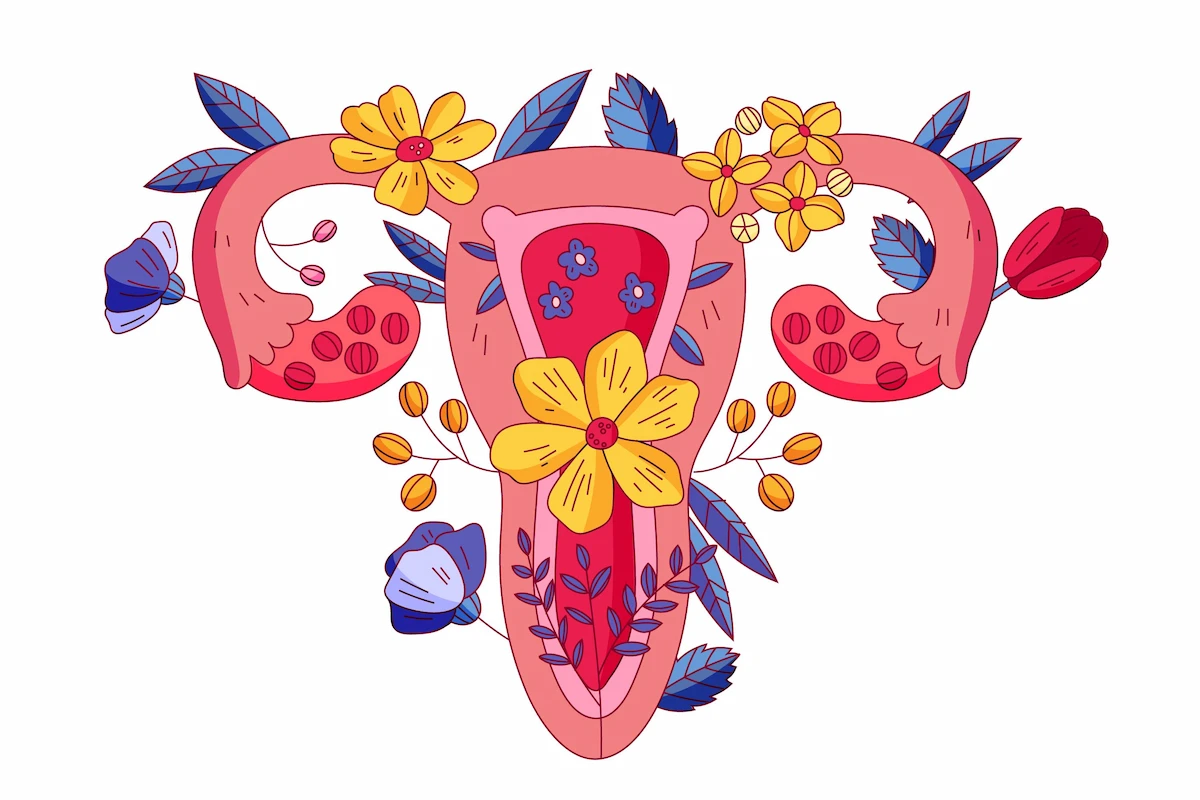 آدنومیوز